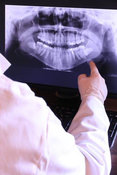 Best Emergency Tooth Extraction in Harper, TX