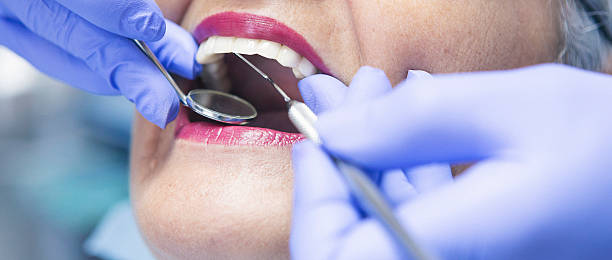 Best Emergency Wisdom Teeth Removal in Harper, TX